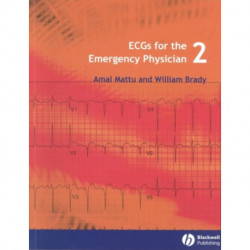 ECGs for the Emergency Physician 2