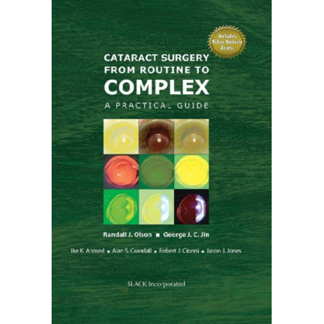 Cataract Surgery from Routine to Complex: A Practical Guide