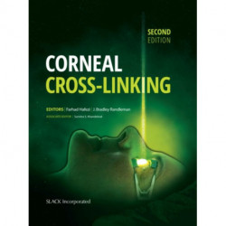Corneal Cross-Linking