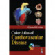Color Atlas of Cardiovascular Disease