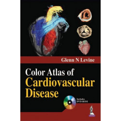 Color Atlas of Cardiovascular Disease