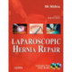 Laparoscopic Hernia Repair