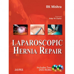 Laparoscopic Hernia Repair