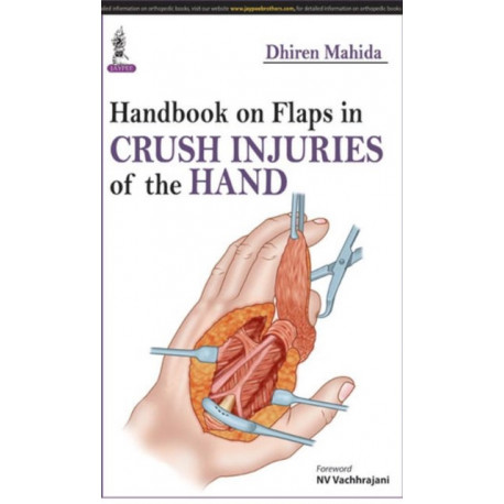 Handbook on Flaps in Crush Injuries of the Hand