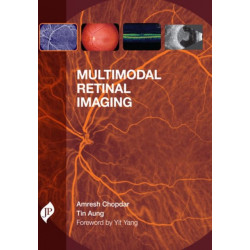 Multimodal Retinal Imaging