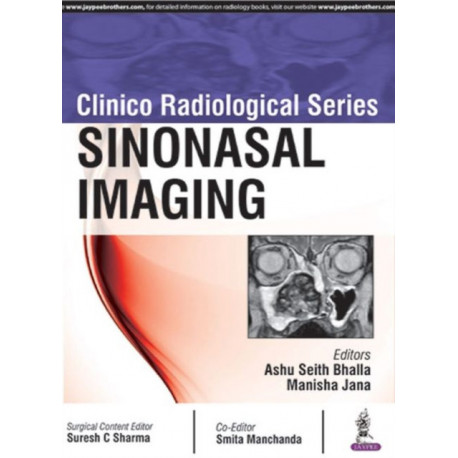 Clinico Radiological Series: Sinonasal Imaging