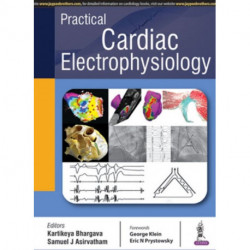 Practical Cardiac Electrophysiology