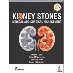 Kidney Stones: Medical and Surgical Management