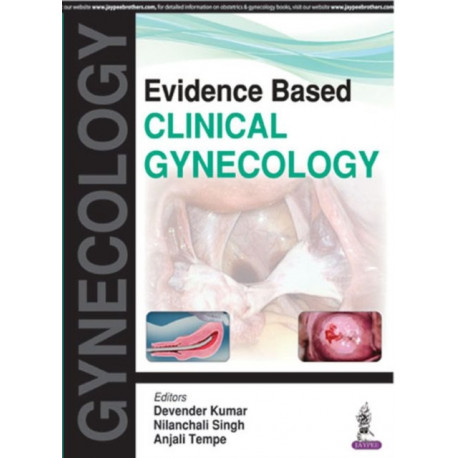 Evidence Based Clinical Gynecology