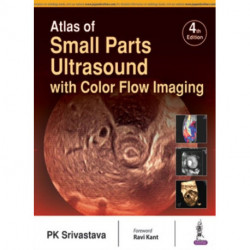 Atlas of Small Parts Ultrasound: with Color Flow Imaging