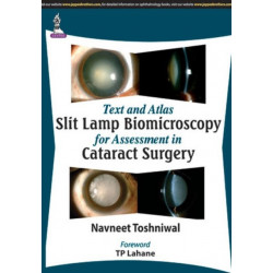 Text and Atlas: Slit Lamp Biomicroscopy for Assessment in Cataract Surgery