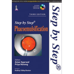 Step by Step Phacoemulsification