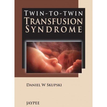 Twin-to-Twin Transfusion Syndrome