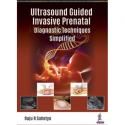 Ultrasound Guided Invasive Prenatal Diagnostic Techniques Simplified