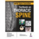 WFNS Spine Committee Textbook on Thoracic Spine