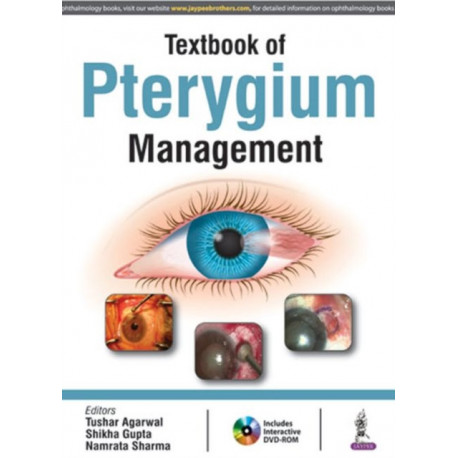 Textbook of Pterygium Management