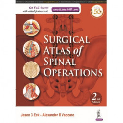 Surgical Atlas of Spinal Operations