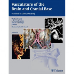 Vasculature of the Brain and Cranial Base