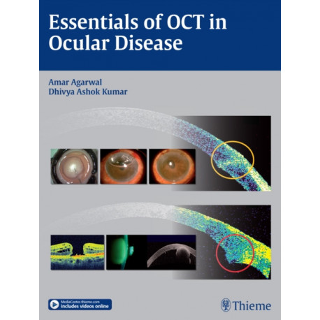 Essentials of OCT in Ocular Disease