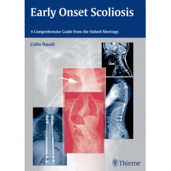 Early Onset Scoliosis: A Comprehensive Guide from the Oxford Meetings