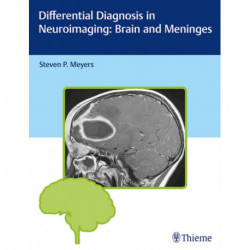 Differential Diagnosis in Neuroimaging: Brain and Meninges
