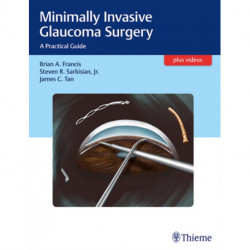 Minimally Invasive Glaucoma Surgery: A Practical Guide