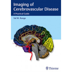 Imaging of Cerebrovascular Disease: A Practical Guide