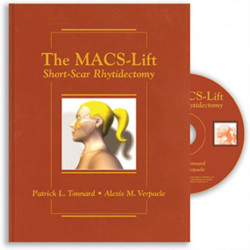 The MACS-Lift: Short-Scar Rhytidectomy