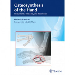 Osteosynthesis of the Hand: Instruments, Implants, and Techniques
