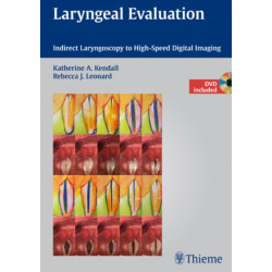 Laryngeal Evaluation: Indirect Laryngoscopy to High-Speed Digital Imaging