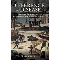 Difference and Disease: Medicine, Race, and the Eighteenth-Century British Empire