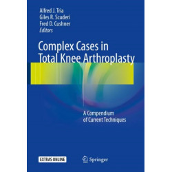 Complex Cases in Total Knee Arthroplasty: A Compendium of Current Techniques