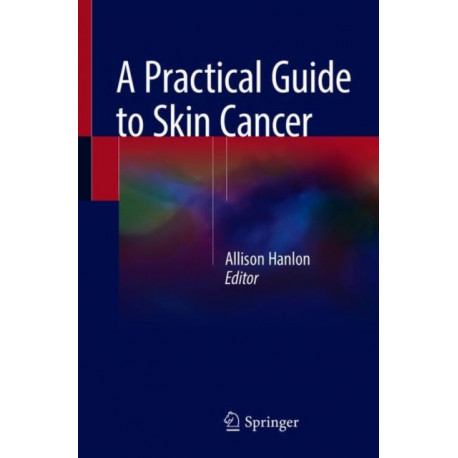 A Practical Guide to Skin Cancer