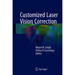 Customized Laser Vision Correction