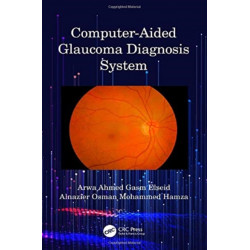 Computer-Aided Glaucoma Diagnosis System