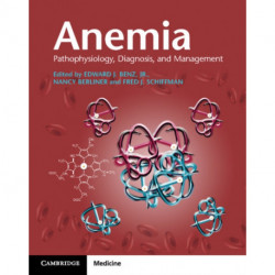 Anemia Paperback with Online Resource: Pathophysiology, Diagnosis, and Management