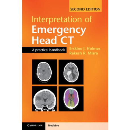 Interpretation of Emergency Head CT: A Practical Handbook