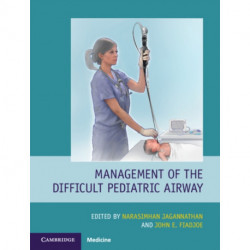 Management of the Difficult Pediatric Airway
