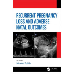 Recurrent Pregnancy Loss and Adverse Natal Outcomes