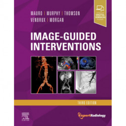 Image-Guided Interventions: Expert Radiology Series