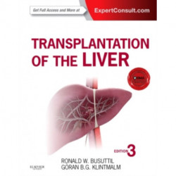 Transplantation of the Liver