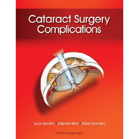 Cataract Surgery Complications