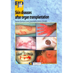Skin Diseases After Organ Transplantation