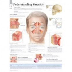Understanding Sinusitis Laminated Poster