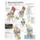 Rheumatoid Arthritis Paper Poster