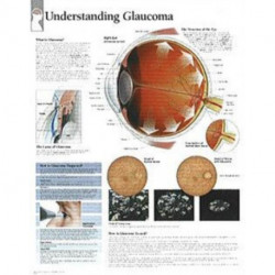 Understanding Menopause Paper Poster