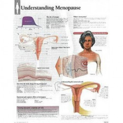 Understanding Menopause Laminated Poster