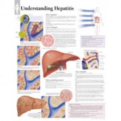 Understanding Hepatitis Laminated Poster