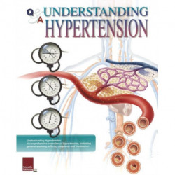 Understanding Hypertension Flip Chart