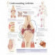 Understanding Arthritis Laminated Poster